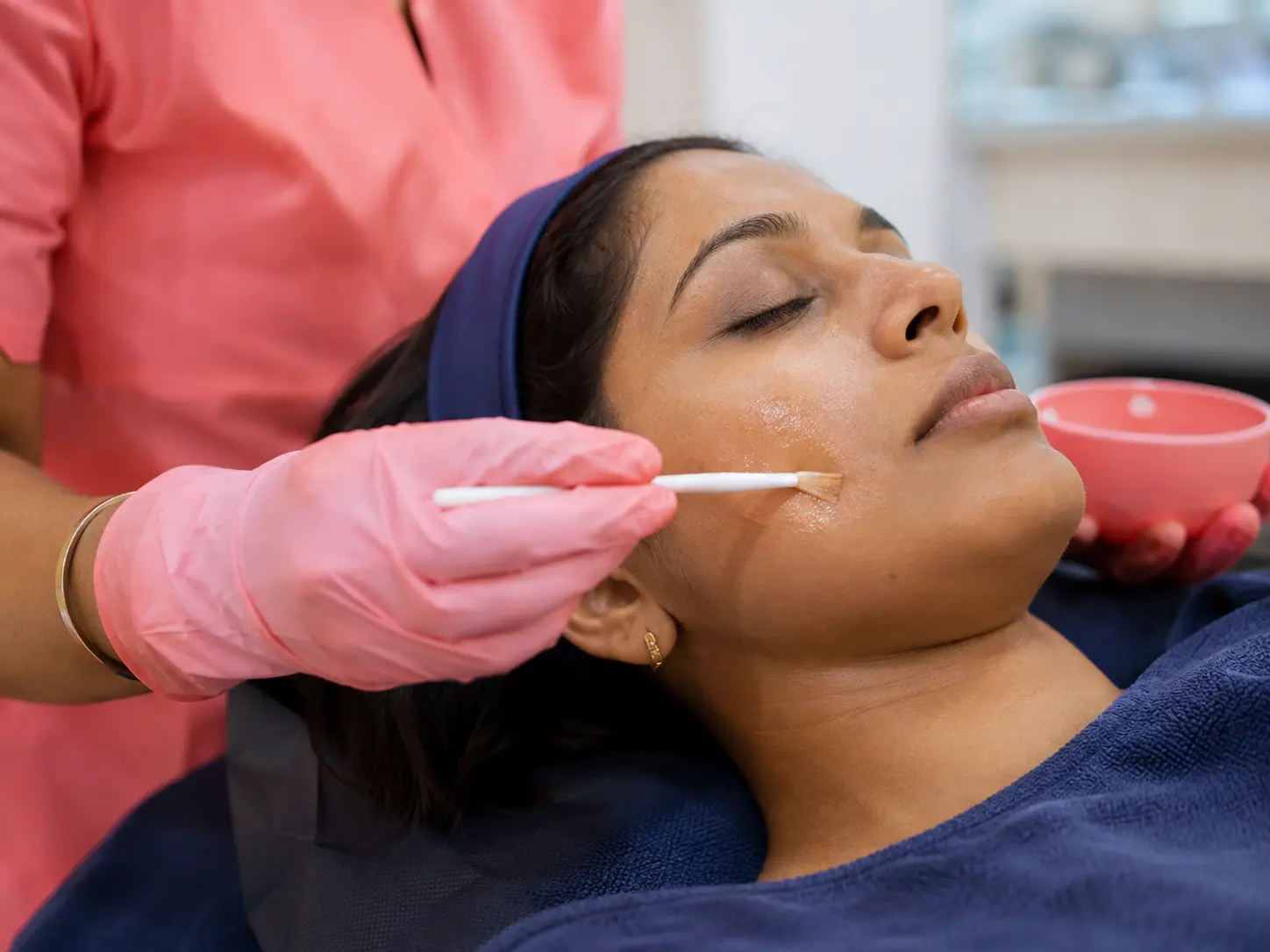Chemical peel solution being applied to a patient's skin during a pigmentation treatment session at Smart Surgeons Trivandrum